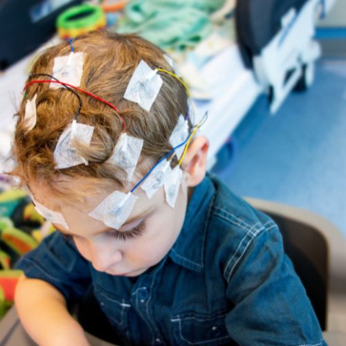 Gyerekkori epilepszia - Gyermekgyógyászati Központ